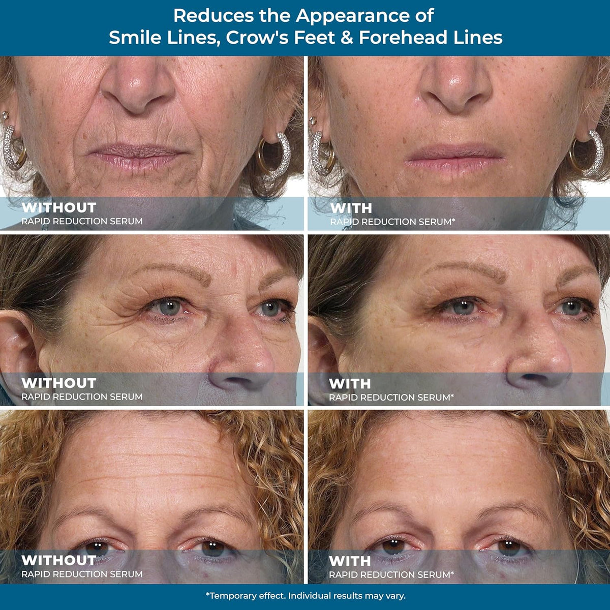 Rapid Reduction Eye Serum Q904